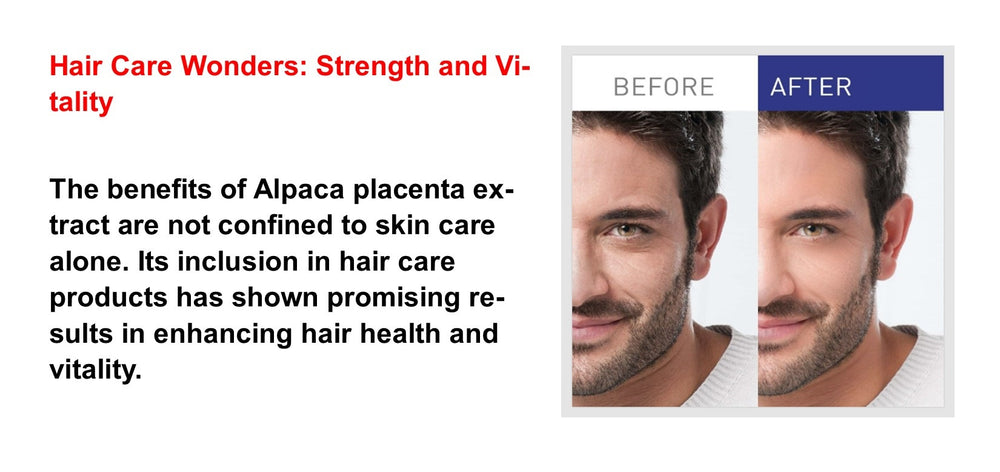 ANTI AGING FORMULA - ALPACA DNA PLACENTA - 3 BOTTLES - Made USA