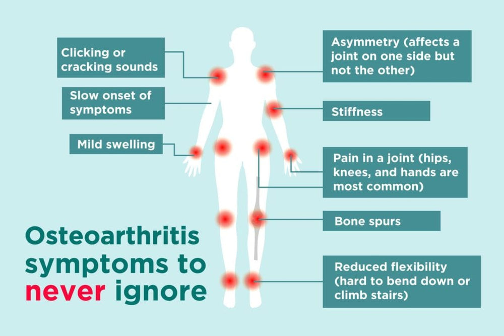 STOP THE ARTHRITIS PAIN RIGHT NOW - STRONGEST CREAM PAIN KILLER - arthritis, osteoarthritis, hip dysplasia - MADE IN USA