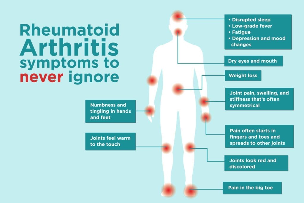 STOP THE ARTHRITIS PAIN RIGHT NOW - STRONGEST CREAM PAIN KILLER - arthritis, osteoarthritis, hip dysplasia - MADE IN USA