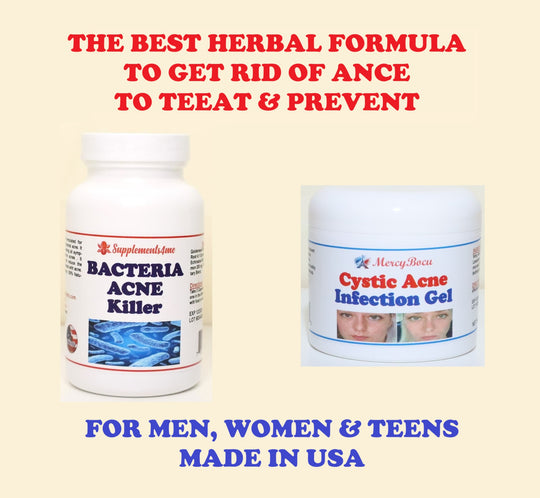 GET RID OF CYST ACNE - KILL BACTERIA ACNE & CYST ACNE 4 ME - Made in USA -