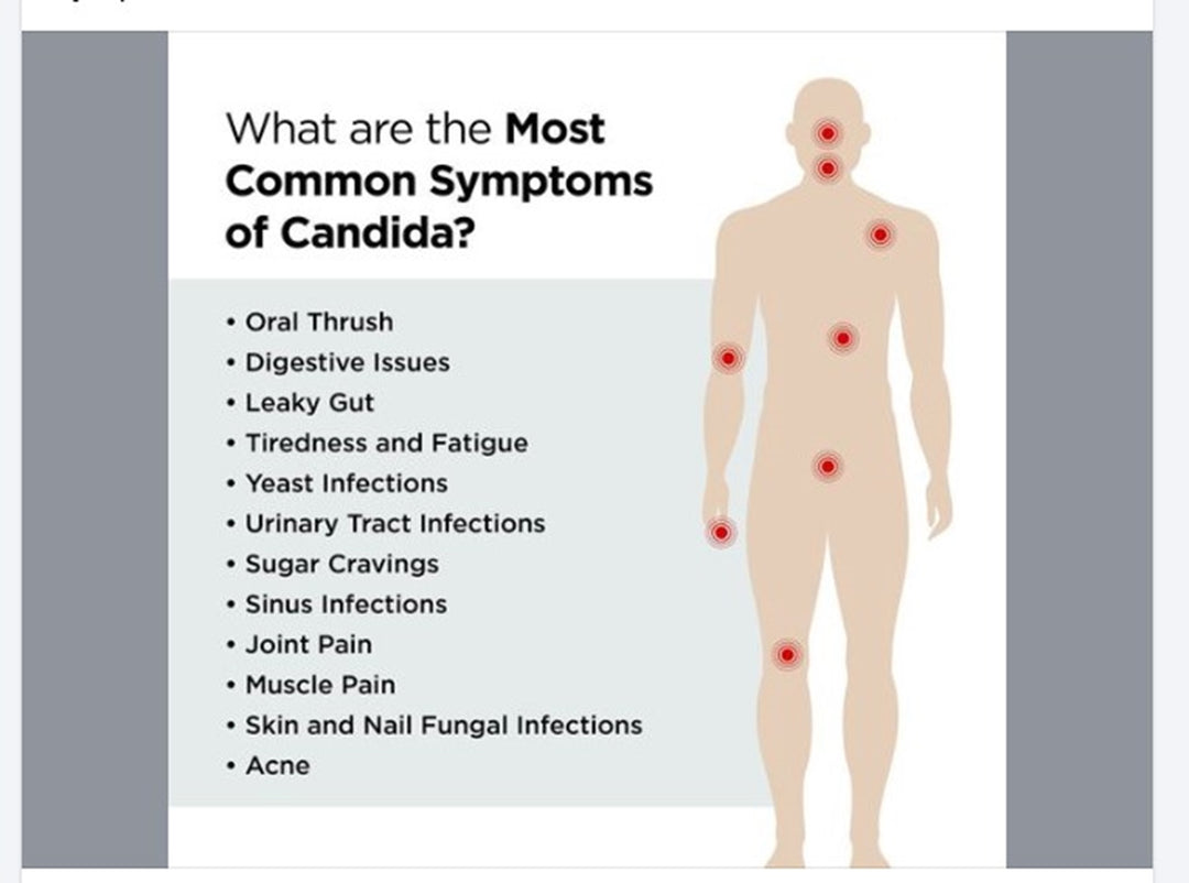 STOP CANDIDIASIS FUNGUS PAIN NOW- STRONGEST PAIN KILLER FOR CANDIDA ALBICANS - MADE IN USA