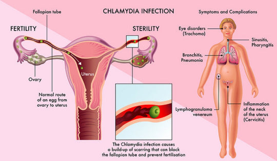 GET RID OF CHLAMYDIA BACTERIAL INFECTION - GUMMIES - TREAT & PREVENT - MEN & WOMEN antibacterial - MADE IN USA