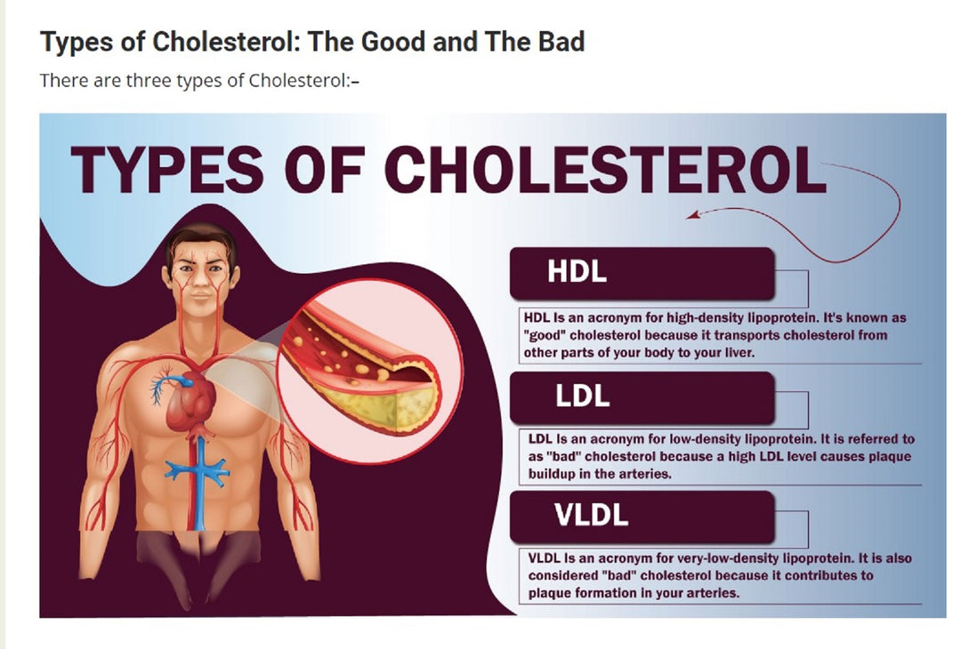 GET RID OF BAD CHOLESTEROL -  REMOVER & FLUSHER ANTIOXIDANT SUPPLEMENT - MADE IN USA