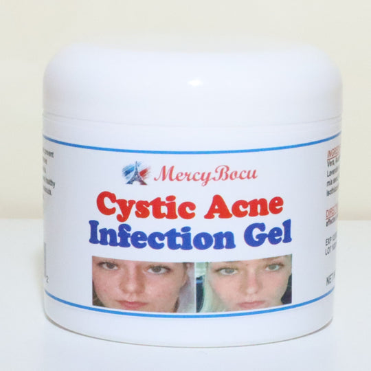 GET RID OF CYSTIC ACNE BACTERIAL - REMOVE ANY CYST ACNE FROM YOUR FACE - Made in USA