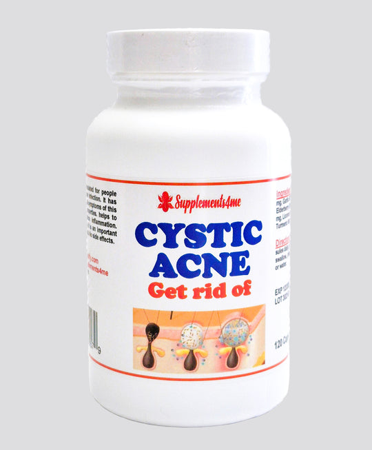 GET RID OF CYSTIC ACNE BACTERIAL - REMOVE ANY CYST - Made in USA -