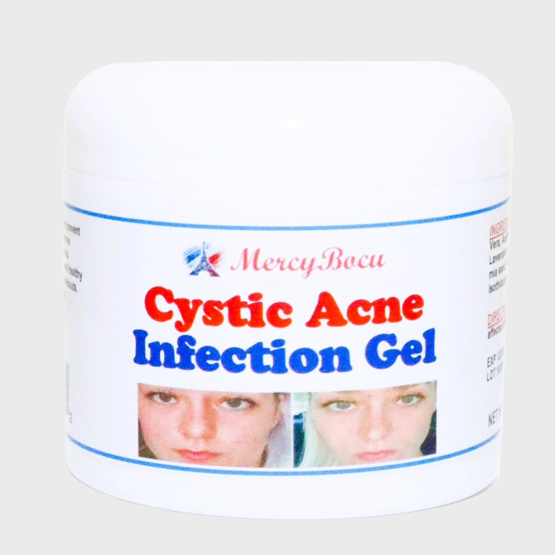 GET RID OF CYSTIC ACNE BACTERIAL - REMOVE ANY CYST ACNE FROM YOUR FACE - Made in USA