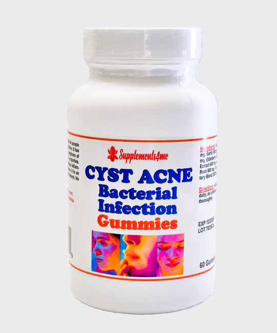GET RID OF CYSTIC ACNE BACTERIAL - REMOVE ANY CYST ACNE FROM YOUR FACE - GUMMIES - Made in USA
