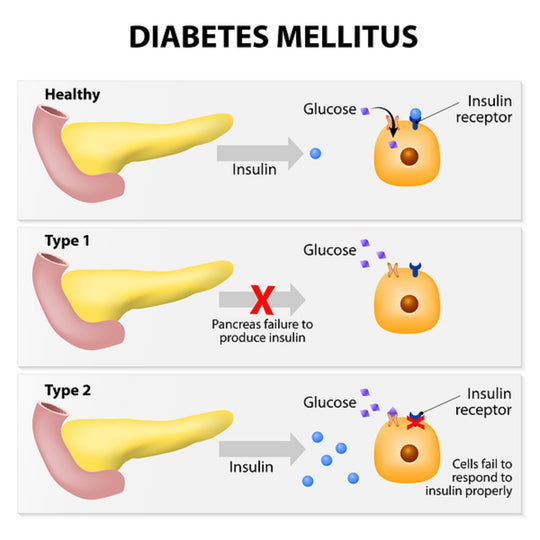 BRING DIABETES DOWN IMMEDIATELY - LOWER & CONTROL HIGH BLOOD SUGAR - MADE IN USA