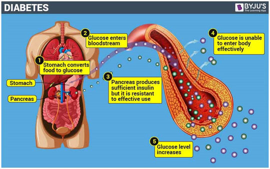 GET RID OF DIABETES NATURALLY - LOWER THE HIGH BLOOD SUGAR - TEAT & PREVENT - 3 BOTTLES - MADE IN USA