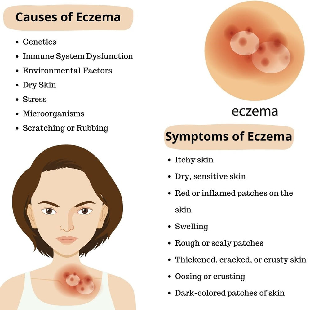 GET RID OF ECZEMA SKIN DISEASE - REDUCE SCALING & ITCHING - MADE IN USA