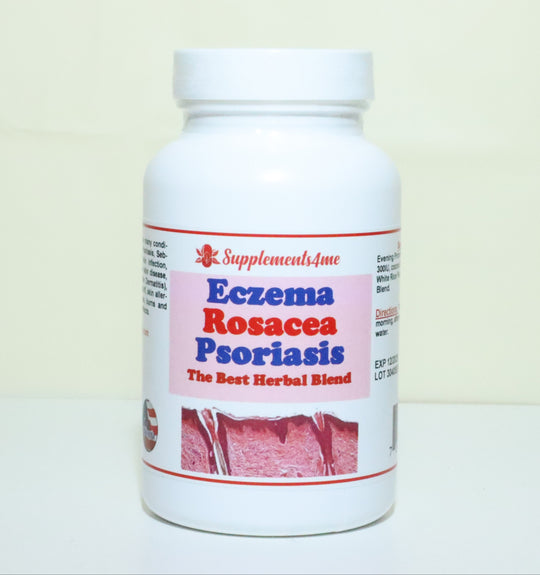 GET RID OF ECZEMA, ROSACEA & PSORIASIS NATURALLY - Prevent and Treat - MADE IN USA