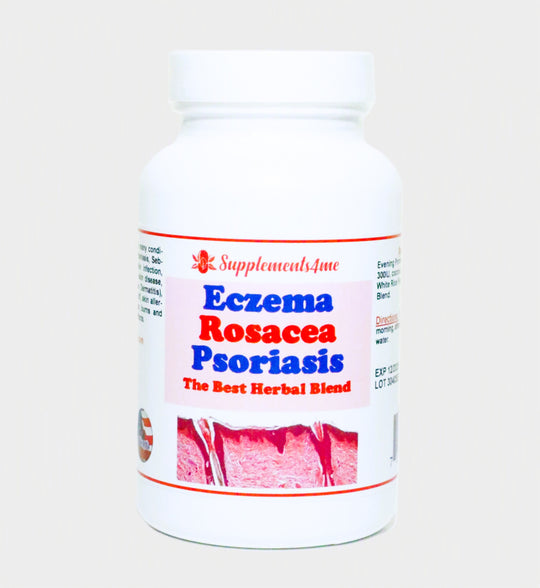GET RID OF ECZEMA, ROSACEA & PSORIASIS NATURALLY - Prevent and Treat - MADE IN USA