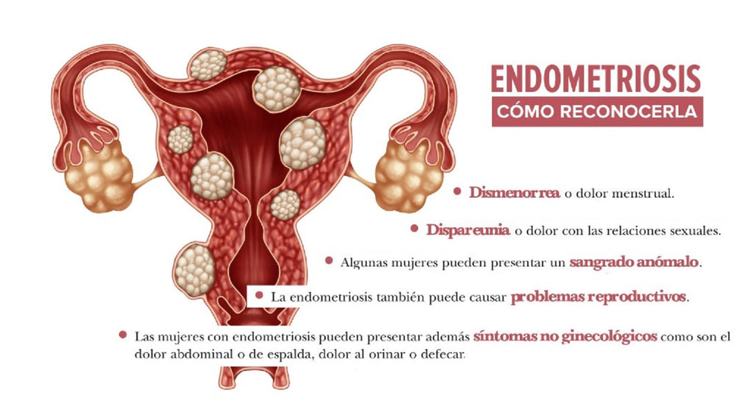 STOP THE ENDOMETRIOSIS PAIN NATURALLY - TREAT & PREVENT - STRONGEST PAIN KILLER - MADE IN USA
