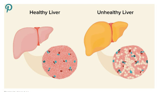 GET RID OF FATTY LIVER NATURALLY - STRONG DETOXING LIVER - MADE IN USA
