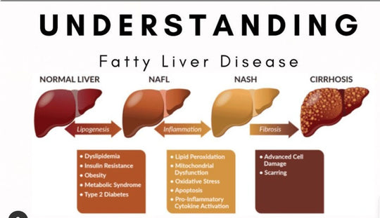 GET RID OF FATTY LIVER NATURALLY - STRONG DETOXING LIVER - MADE IN USA
