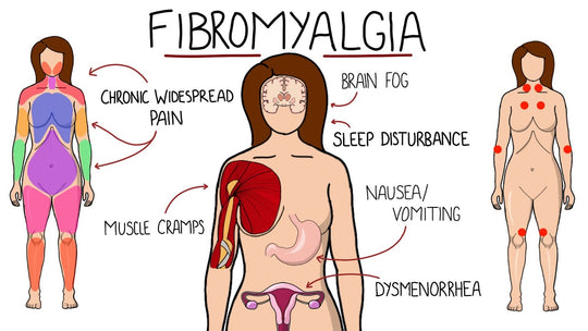 STOP FIBROMYALGIA PAIN RIGHT NOW - STRONGEST FIBRO PAIN KILLER - MADE IN USA