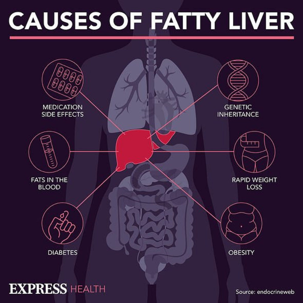 GET RID OF FATTY LIVER DISEASE NOW -The best fat removers for the liver naturally - MADE IN USA