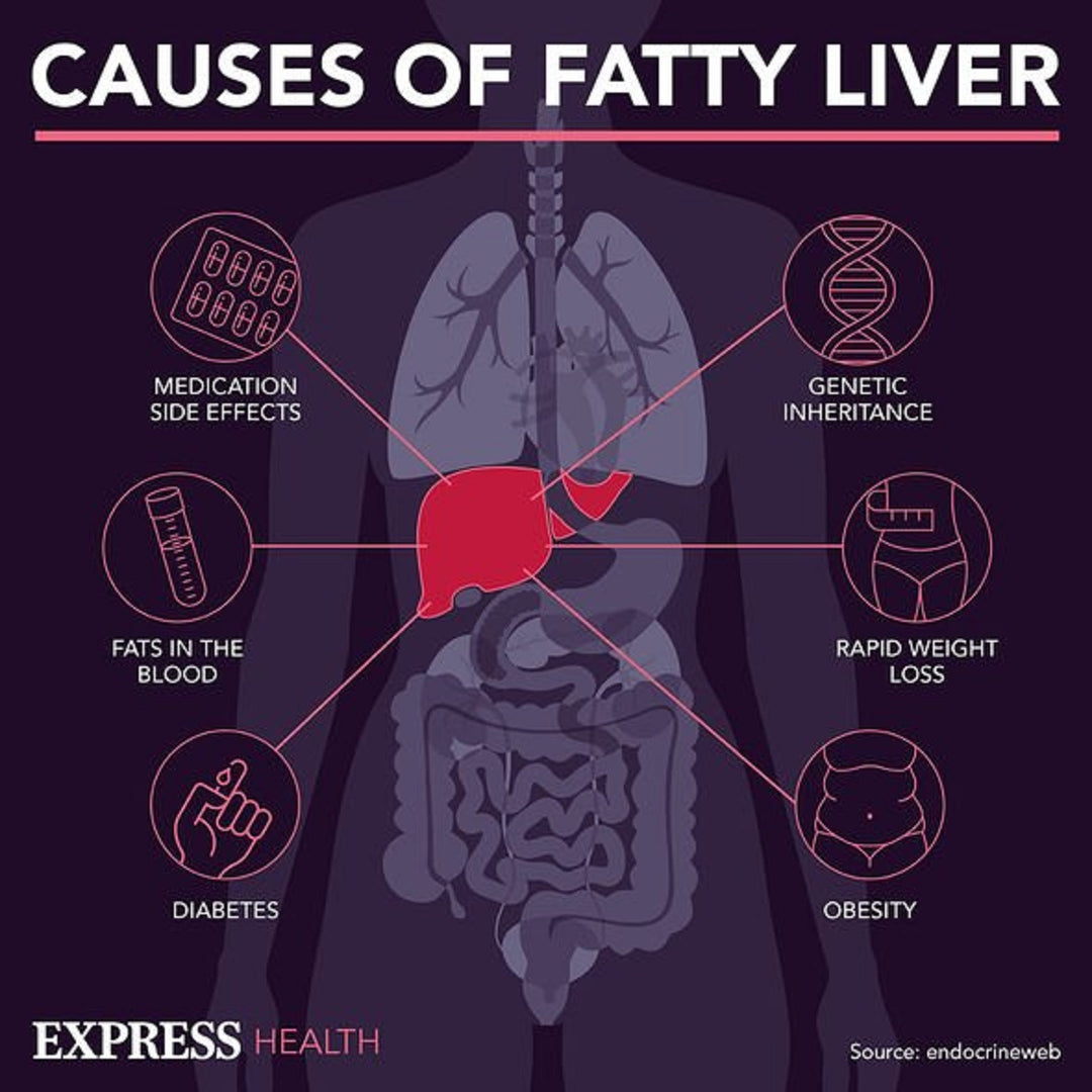 GET RID OF FATTY LIVER NATURALLY -  WOMEN & MEN - ELIMINATE FATTY LIVER - MADE