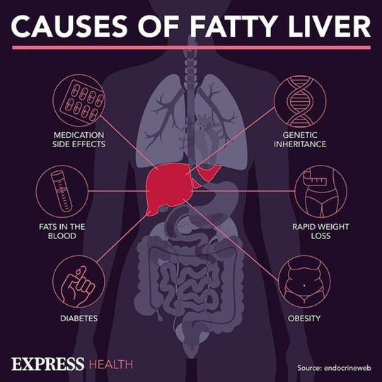 GET RID OF FATTY LIVER NATURALLY -  WOMEN & MEN - ELIMINATE FATTY LIVER - MADE