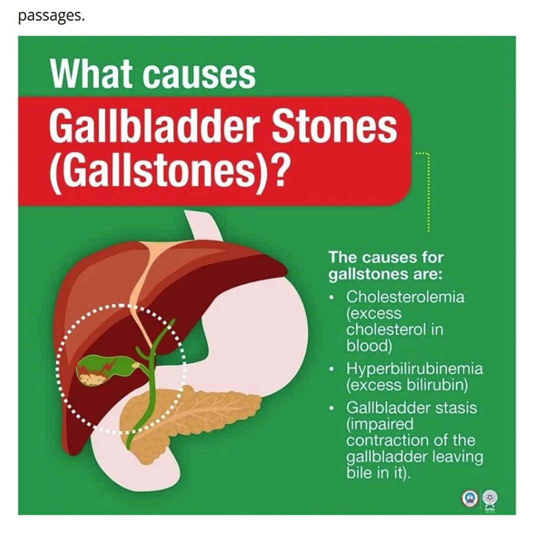 GET RID OF KIDNEY STONE & GALLBLADDER STONE BREAKER - MADE IN USA