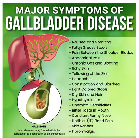 GET RID OF GALLBLADDER STONES NOW - GALLSTONES BREAKER -  BEST HERBAL FORMULA - MADE IN USA