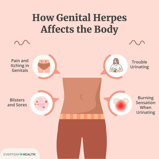 STOP THE GENITAL HERPES 1 & 2 PAIN NOW - EXTRA STRENGTH - STRONGEST PAIN KILLER -MADE IN USA