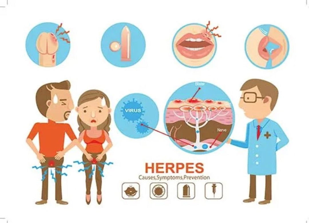 STOP THE GENITAL HERPES 1 & 2 PAIN NOW - EXTRA STRENGTH - STRONGEST PAIN KILLER -MADE IN USA