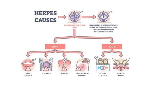 STOP THE GENITAL HERPES 1 & 2 PAIN NOW - EXTRA STRENGTH - STRONGEST PAIN KILLER -MADE IN USA