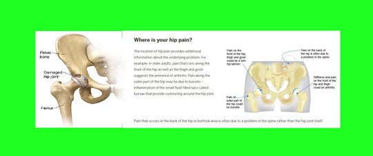 STOP HIP JOINT PAIN RIGHT NOW  - hip dysplasia , arthritis - STRONGEST PAIN KILLER IN CREAM - MADE IN USA