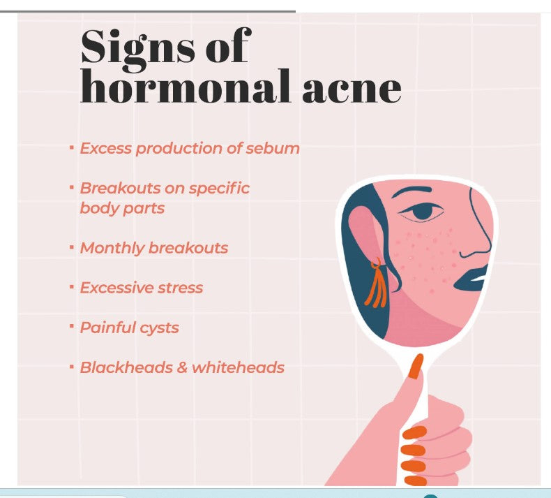 GET RID OF ACNE HORMONAL FOR WOMEN - BALANCE THE ESTROGEN & PROGESTERONE LEVELS - MADE IN USA