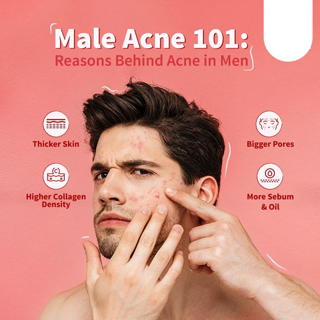 GET RID OF ACNE HORMONAL FOR MEN - BALANCE THE OVERPRODUCTION OF TESTOSTERONE - MADE IN USA