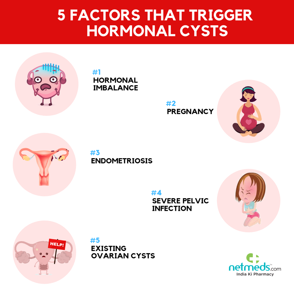 GET RID OF HORMONAL CYST NATURALLY - ELIMINATE ANY OVARIAN CYST - Made in USA