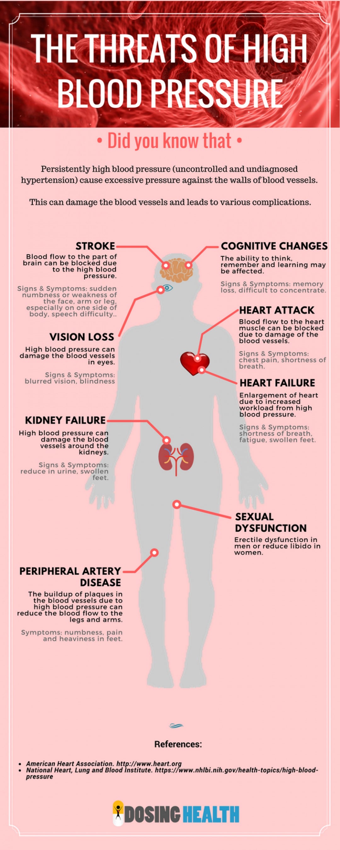GET RID OF HIGH BLOOD PRESSURE NATURALLY - Lower BP Naturally - ELIMINATE Hypertension - MADE IN USA