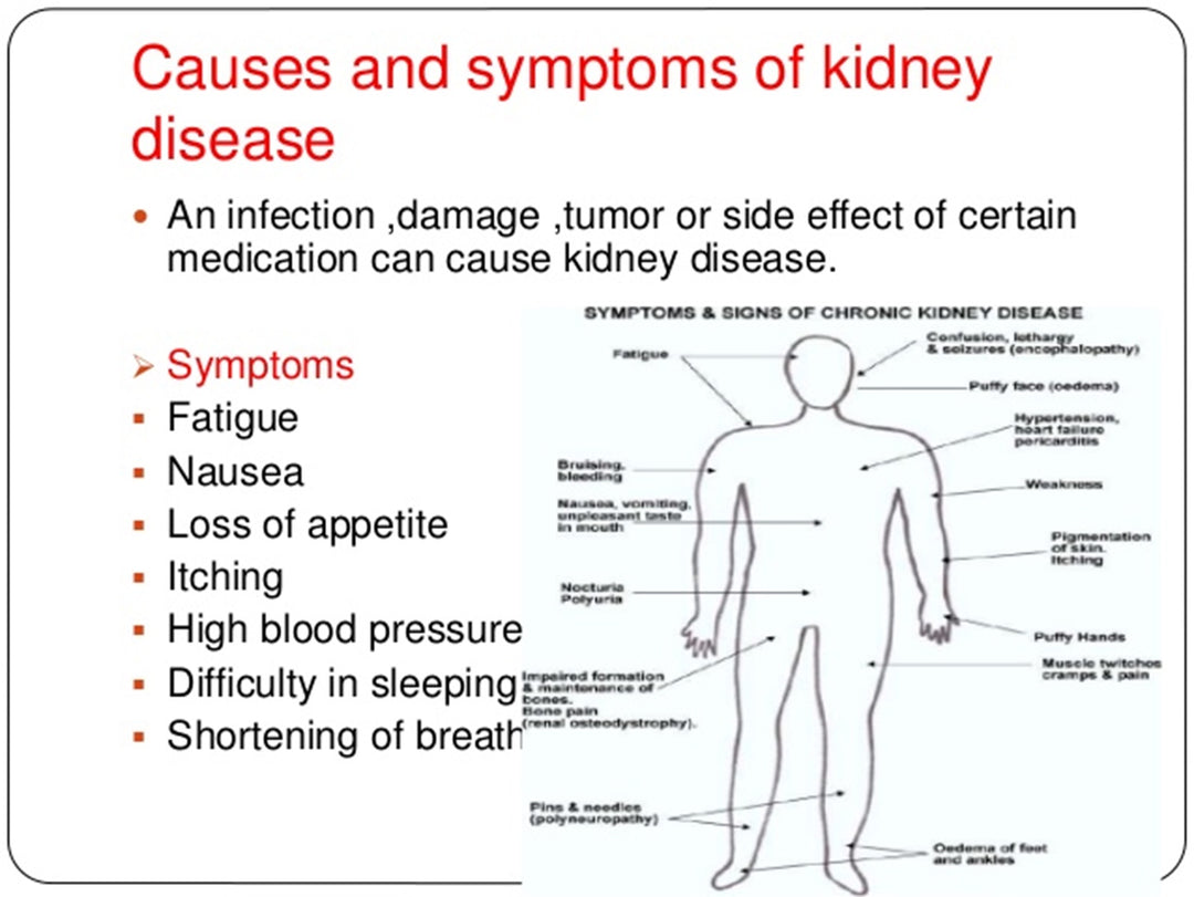 GET RID OF ANY BLADDER & KIDNEY DISEASE - Cleanse, Detox & Repair - ELIMINATE STONES - MADE IN USA