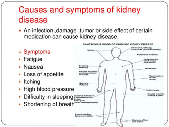 GET RID OF ANY BLADDER & KIDNEY DISEASE - Cleanse, Detox & Repair - ELIMINATE STONES - MADE IN USA