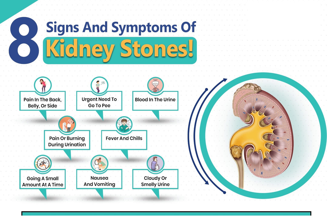 GET RID OF GALLBLADDER STONES & KIDNEY STONES - HERBAL STONES BREAKER - MADE IN USA
