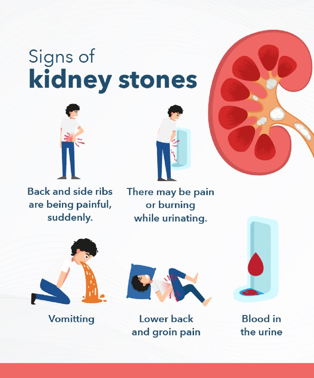 GET RID OF KIDNEY STONES NATURALLY - BEST HERBAL FORMULA TO BREAK KIDNEY STONES - STOP PAIN - MADE IN USA