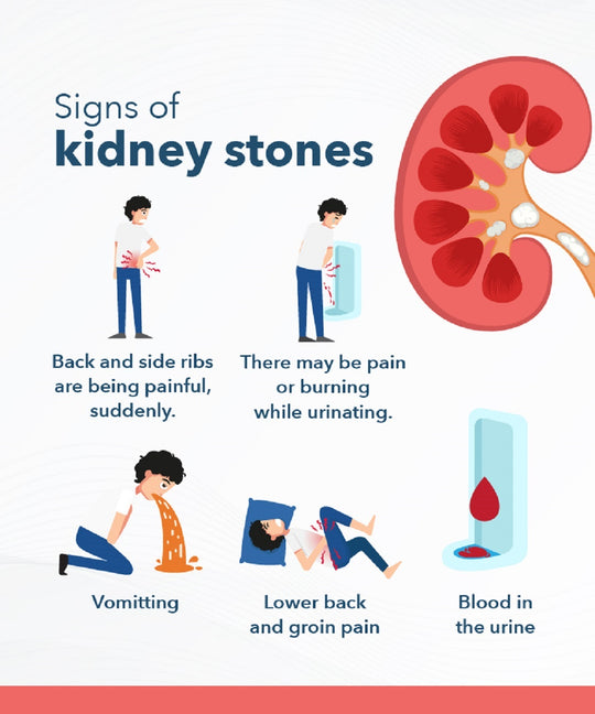 GET RID OF GALLBLADDER STONES & KIDNEY STONES - HERBAL STONES BREAKER - MADE IN USA