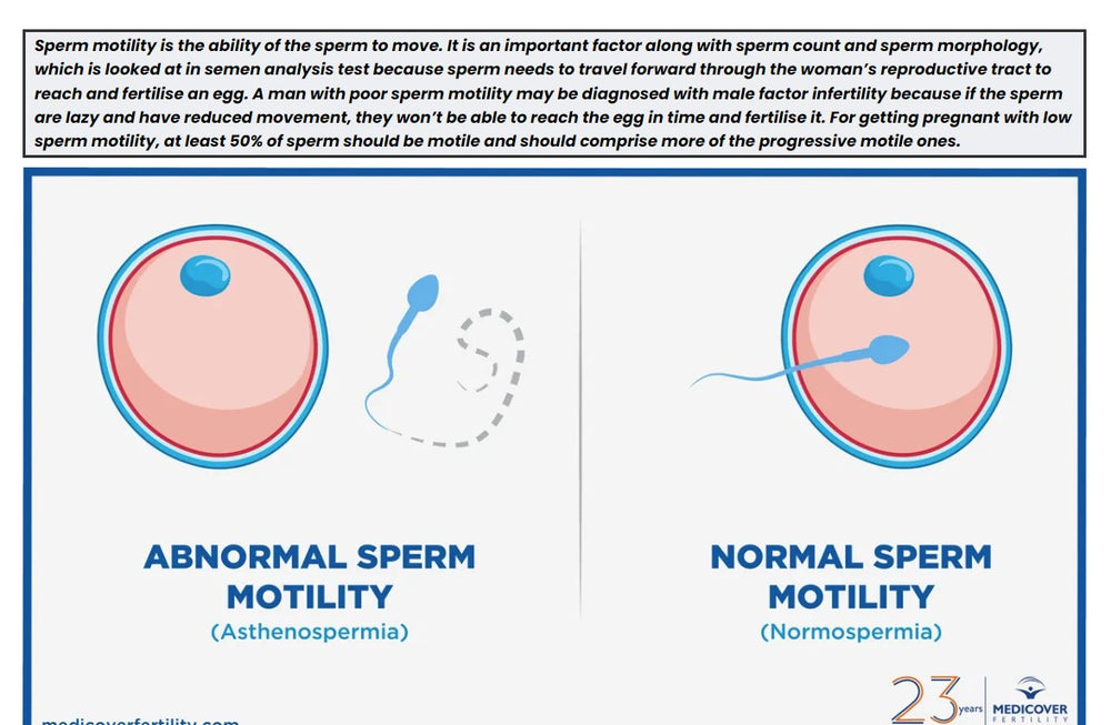 INCREASE SPERM MOTILITY NATURALLY - SPERM MOTILITY BOOSTER - MADE IN USA