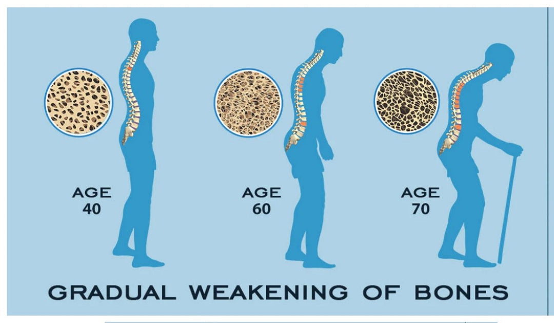 SLOW DOWN OSTEOPOROSIS DISEASE - STOP BONE LOSS NATURALLY - SUPER BONE BOOSTER BUILDER - MADE IN USA