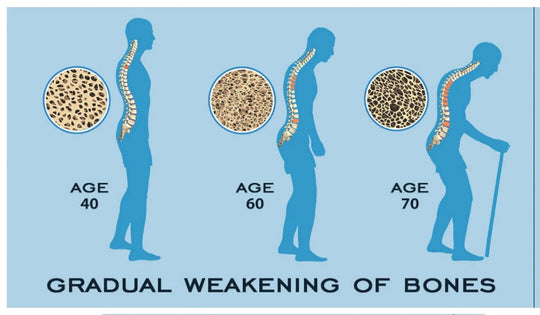 SLOW DOWN OSTEOPOROSIS DISEASE - STOP BONE LOSS NATURALLY - SUPER BONE BOOSTER BUILDER - MADE IN USA