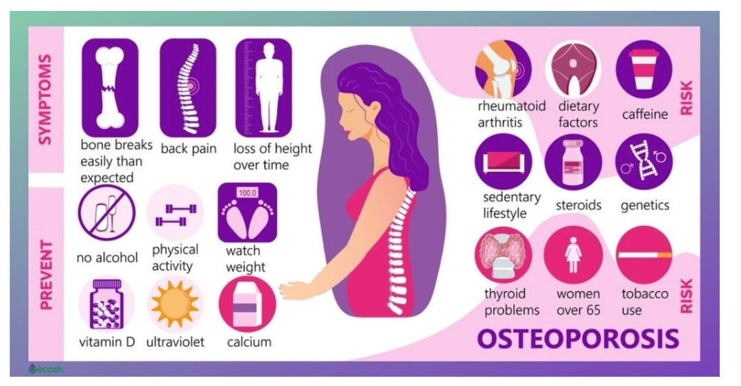 SLOW DOWN OSTEOPOROSIS DISEASE - STOP BONE LOSS NATURALLY - SUPER BONE BOOSTER BUILDER - MADE IN USA
