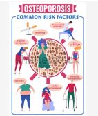 SLOW DOWN OSTEOPOROSIS DISEASE - STOP BONE LOSS NATURALLY - SUPER BONE BOOSTER BUILDER - MADE IN USA