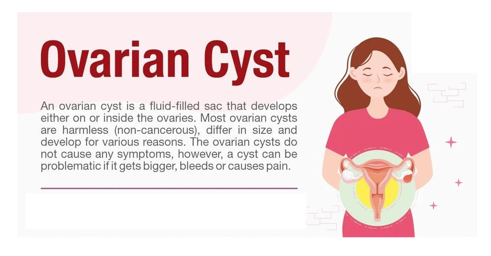 GET RID OF OVARIAN CYST NATURALLY - ELIMINATE ANY CYST IN YOUR BODY - MADE IN USA