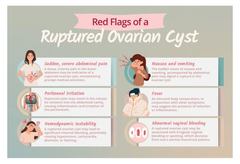 STOP OVARIAN CYST PAIN RELIEF - STRONGEST OVARIAN PAIN KILLER - MADE IN USA