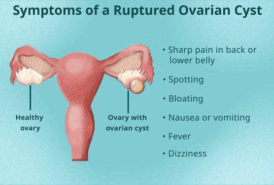 GET RID OF OVARIAN CYST NATURALLY - ELIMINATE ANY CYST IN YOUR BODY - MADE IN USA