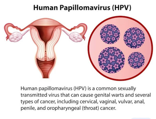 GET RID OF CHLAMYDIA GONORRHEA PAPILLOMA INFECTION -  TREAT & PREVENT - MEN & WOMEN - antibacterial, anti-inflammatory - MADE IN USA