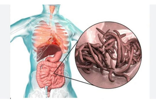 ELIMINATE INTESTINAL PARASITES & WORMS NATURALLY - get rid of intestinal parasites now - MADE IN USA
