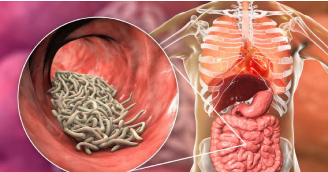ELIMINATE INTESTINAL PARASITES & WORMS NATURALLY - get rid of intestinal parasites now - MADE IN USA