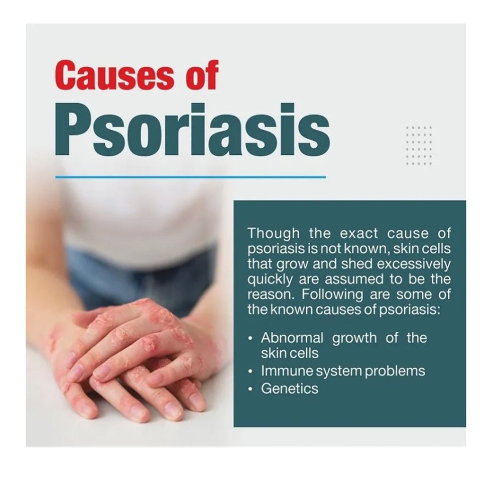 GET RID OF PSORIASIS SKIN DISEASE - REDUCE SCALING & ITCHING - STOP PAIN NOW - MADE IN USA